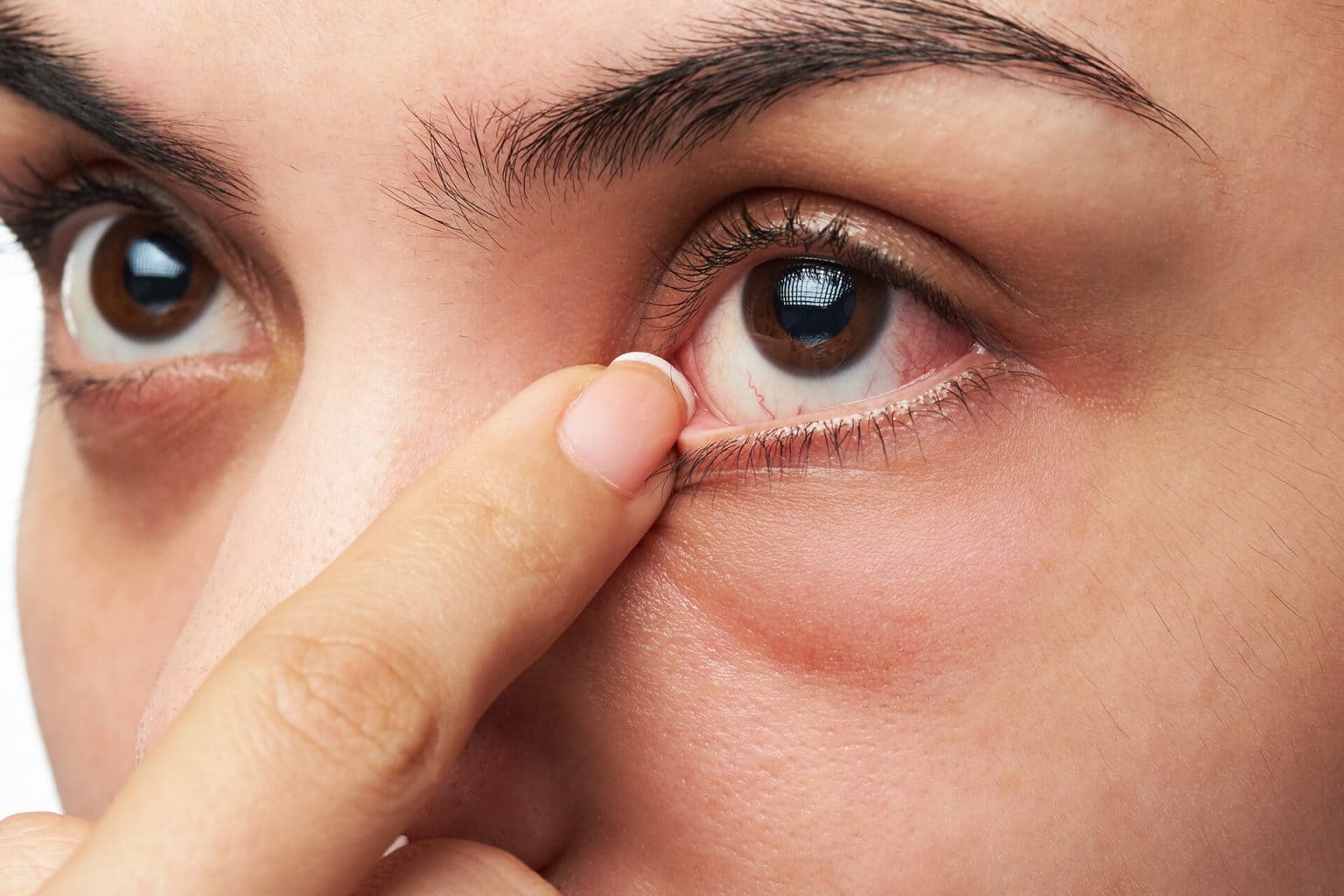 Ojos secos tratamiento precio
